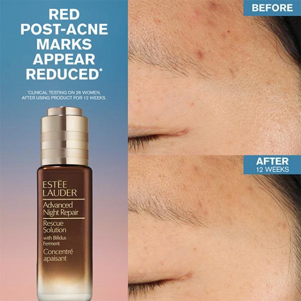 Estée Lauder Advanced Night Repair Rescue Solution 20ml