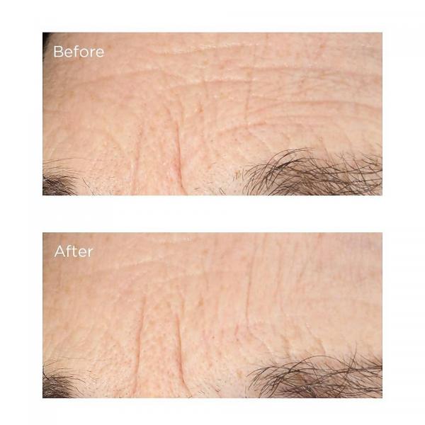 Perricone Md Essential Fx Acyl-Glutathione Deep Crease Serum 30ml 